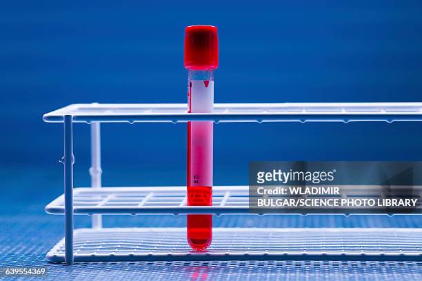 vacutainer tube with blood sample - reageerbuisrek stockfoto's en -beelden