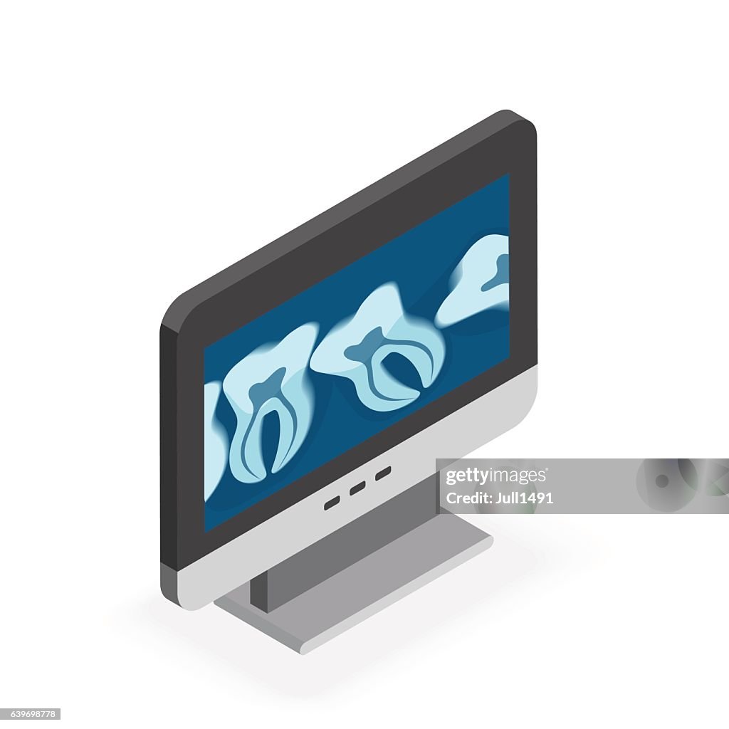 Isometric Monitor Drawing The Monitor Is An Isometric View With Blue Xray High-Res Vector Graphic ...