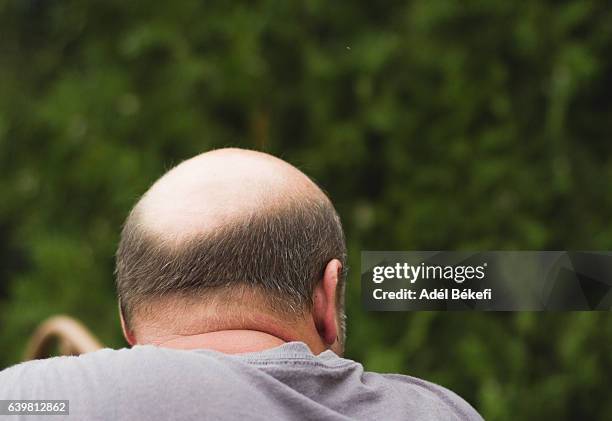 rear view of balding man - calvizie foto e immagini stock