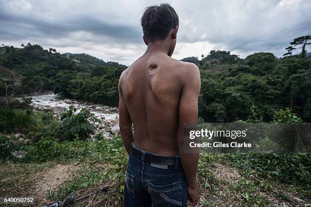 Alan Garcia, an environmental defender, survived being shot at close range by the Honduran Military during a protest against the Agua Zarca Dam. The...