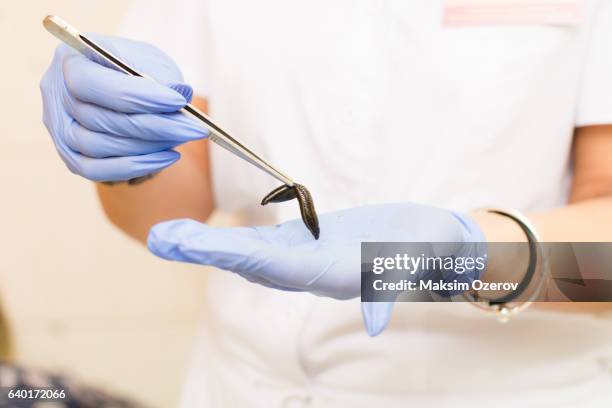 doctor holding a medical leech - sanguijuela fotografías e imágenes de stock