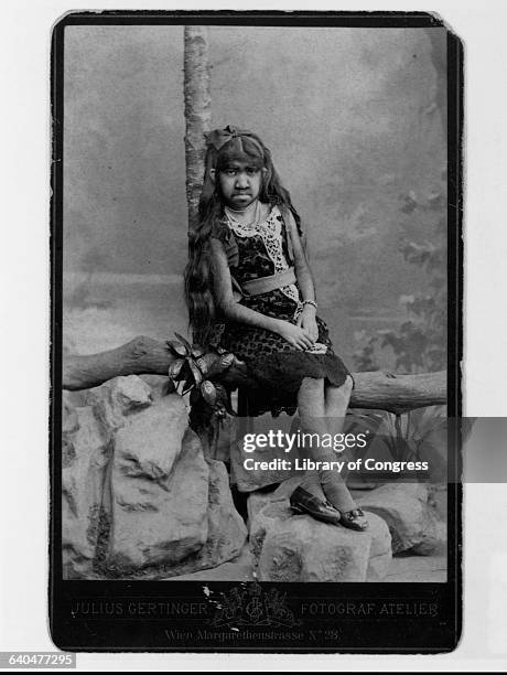 Krao Farini was an hirsute, flexibly jointed woman found in the Laotian jungle in 1885, and put on display by P.T. Barnum as a "missing link". She...