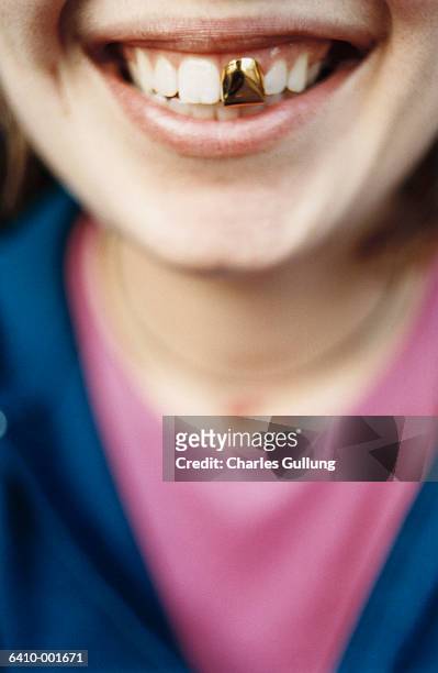 woman with gold dental crown - corona de oro fotografías e imágenes de stock