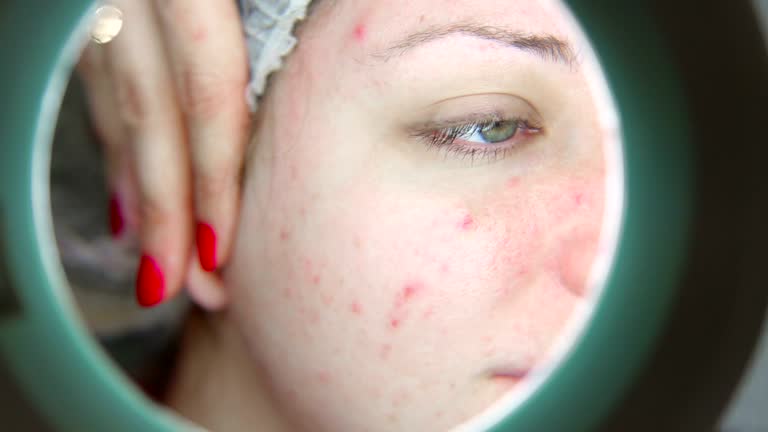 Face With Problem 1,009 Woman Face Skin Problem Stock Videos, Footage, & 4K Video Clips ...