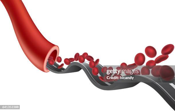 blood - anaemia stock illustrations