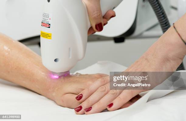 hair removal - beauty laser stock pictures, royalty-free photos & images