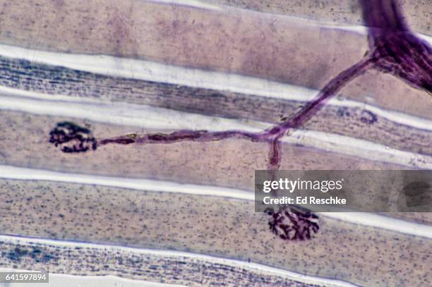 neuromuscular junctions, motor neurons and skeletal muscle fibers - skeletal muscle stock pictures, royalty-free photos & images