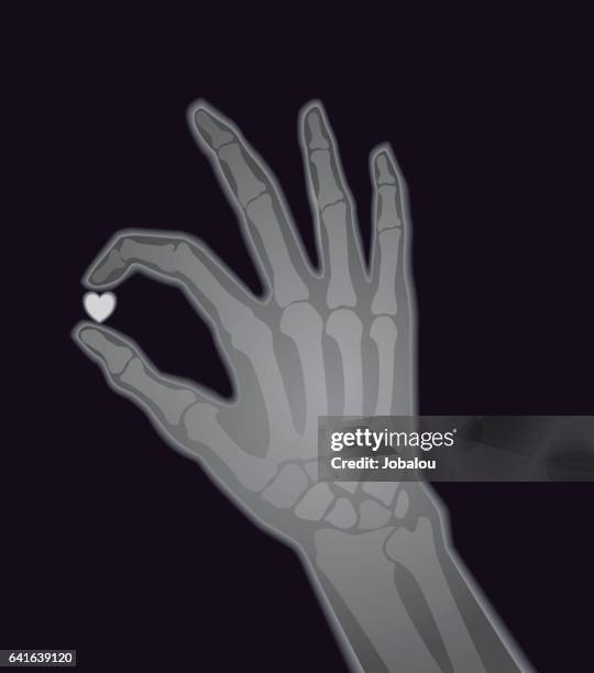 ilustraciones, imágenes clip art, dibujos animados e iconos de stock de rayos x de imagen mano humana en forma de corazón - radiólogo