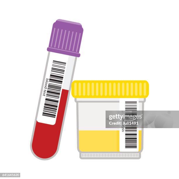illustrazioni stock, clip art, cartoni animati e icone di tendenza di campioni di laboratorio di urina e sangue. - blood