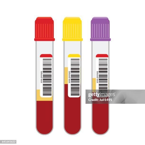 stockillustraties, clipart, cartoons en iconen met bloedmonsters in glazen flesjes met een streepjescode. bloedmonster in vitro. - blood tubes