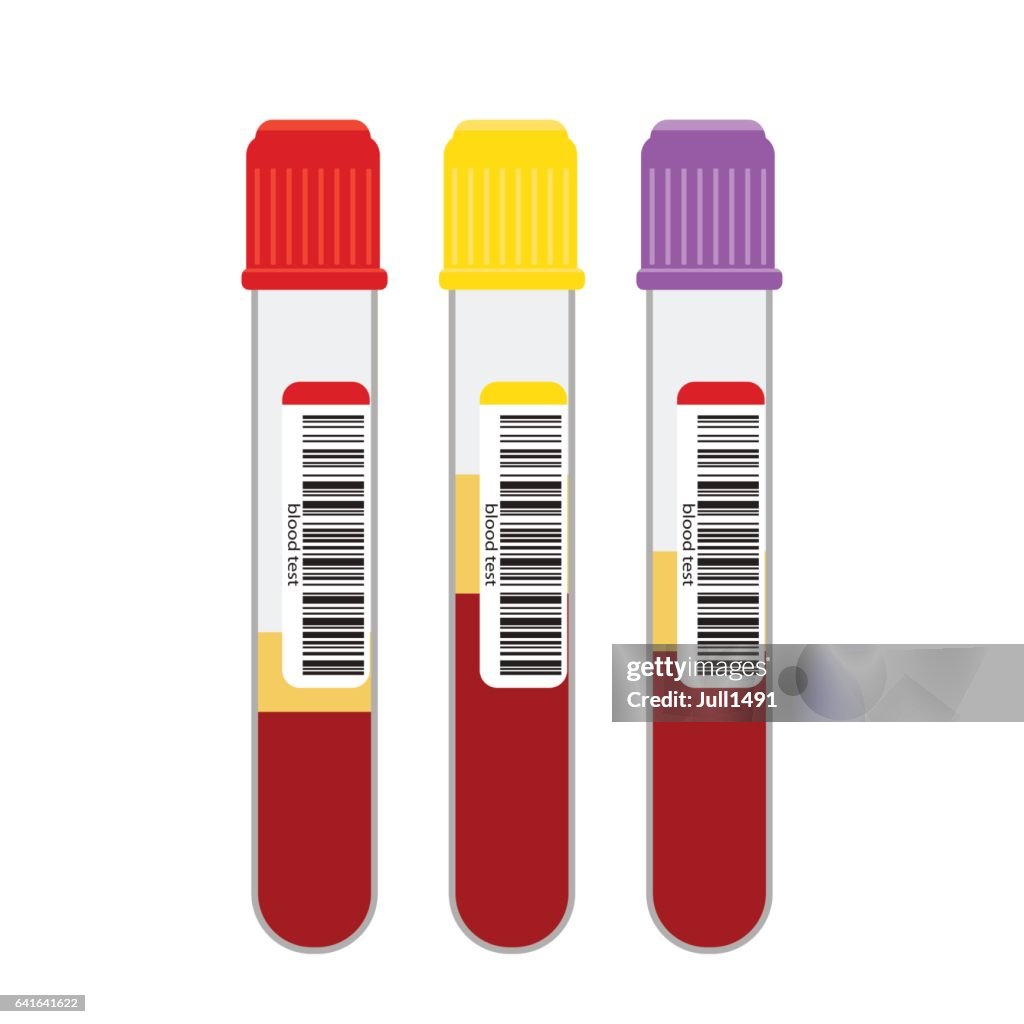 Blood Samples In Glass Vials With A Bar Code Blood Sample In Vitro High ...