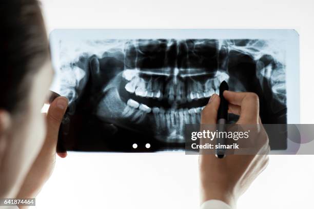 dental x-ray - dental imaging stock pictures, royalty-free photos & images