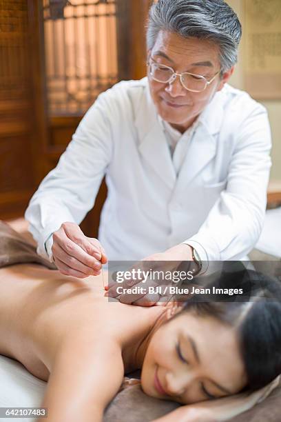 young woman receiving acupuncture - acupuncture elderly stock pictures, royalty-free photos & images