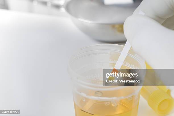 Pee During Routine Pee Cup Photos and Premium High Res Pictures - Getty Images