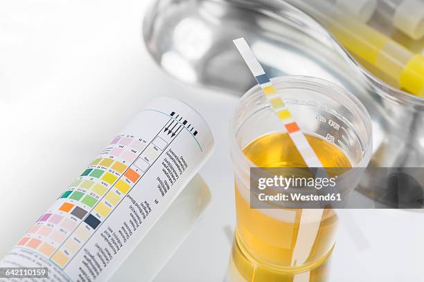 routine test, urine rapid test, urine test strip, urine sample - urine sample stock pictures, royalty-free photos & images