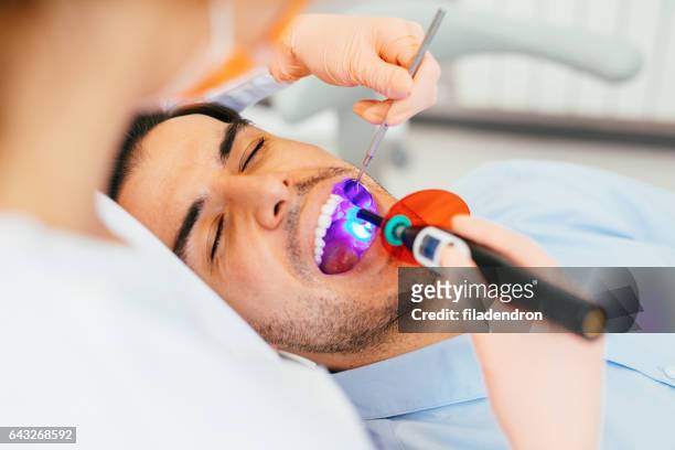 luz de tratamiento dental - human teeth fotografías e imágenes de stock