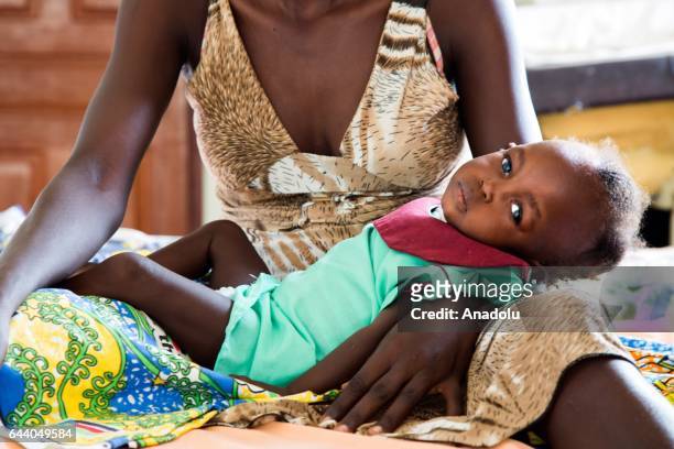 South Sudanese kid Elizabeth Kegi receives treatment at Al Shabbab Hospital in Juba, South Sudan on February 17, 2017. Due to the malnutrition, lack...