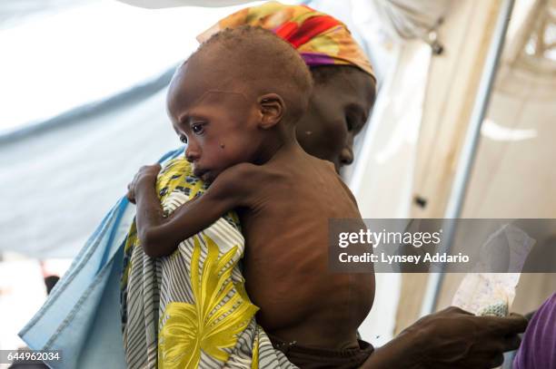 Doctors Without Borders screens and treats malnourished children living in and around Wau Shiluk, who were internally displaced from Malakal, during...