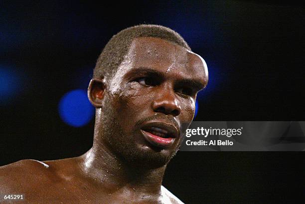 Hasim Rahman shows a bulge on his forehead due to a broken blood vessel after a headbutt by Evander Holyfield during the heavyweight title fight at...
