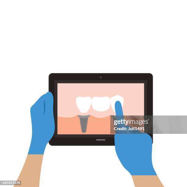 dental bridge on a tablet - dentist computer stock illustrations