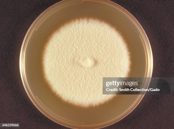 Top view of a Sabouraud dextrose plate culture growing the fungus Microsporum persicolor, known to cause dermatophytosis, 1973. Image courtesy...