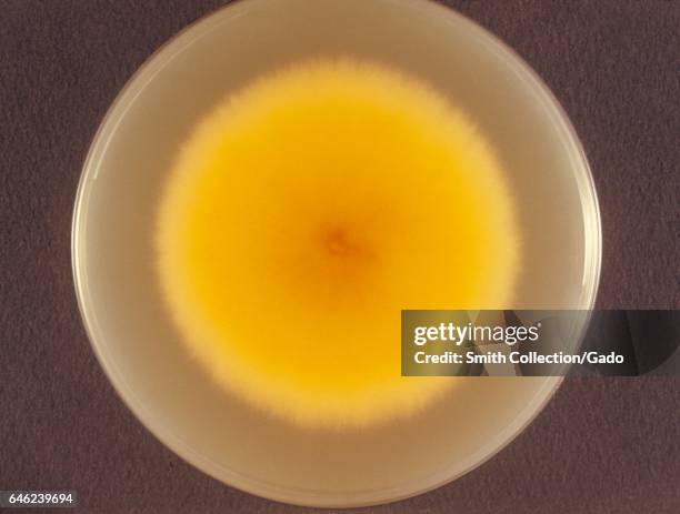 Bottom or "reverse" view of a cereal agar plate culture growing the fungus Microsporum persicolor, known to cause dermatophytosis, 1973. Image...