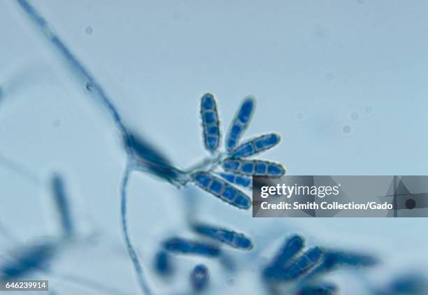 Photomicrograph of a conidia-laden conidiophore of the fungus Ochroconis constricta, formerly known as Heterosporium tschawtschae, 1973. Image...
