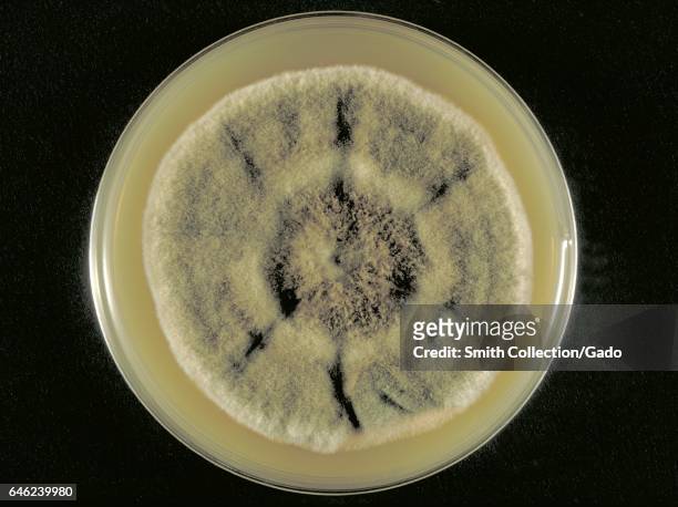 Sabouraud's dextrose agar plate culture growing the fungus Curvularia harveyi, 1973. Image courtesy CDC/Dr. William Kaplan. .
