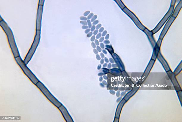 Photomicrograph of a conidia-laden conidiophore of a Phialophora verrucosa fungal organism from a slide culture, 1972. Image courtesy CDC/Dr. Libero...