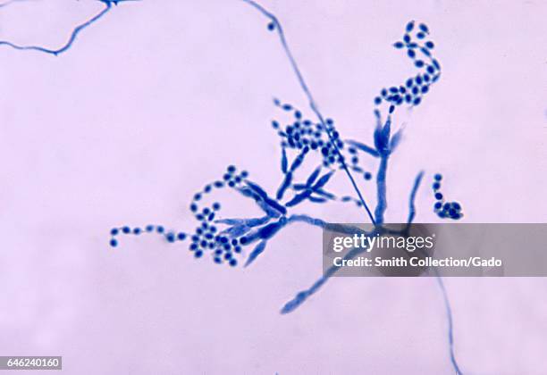 Micrograph of conidia-laden conidiophores and phialides of a Penicillium marneffei fungal organism, 1972. Image courtesy CDC/Dr. Libero Ajello. .