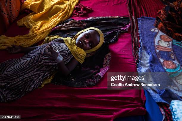 Young girl suffering from malnutrition lies in a bed inside the malnutrition ward at Garowe General Hospital on February 27, 2017 in Garowe, Somalia....