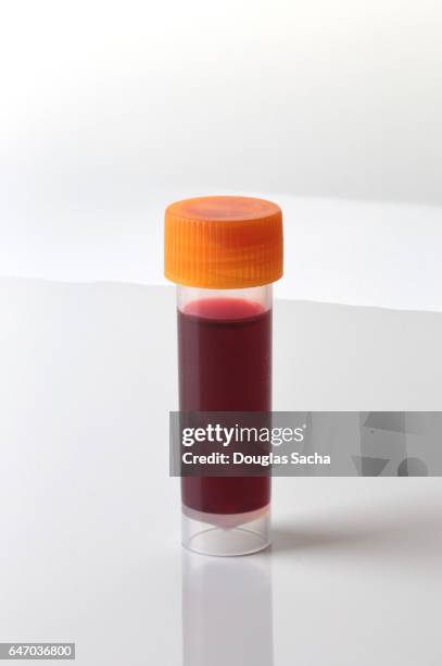 sample of human blood for medical testing - cholesterol test stock pictures, royalty-free photos & images