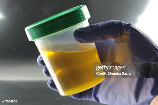 human urine sample in a sealed container - urine sample ストックフォトと画像