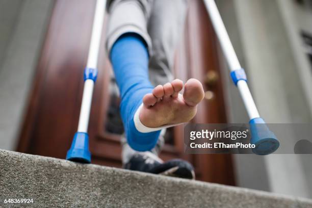young adult walking with plaster bandage on foot - crutch stock-fotos und bilder