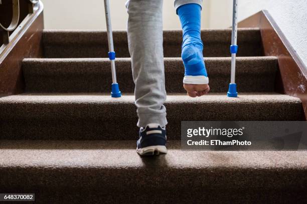 young adult walking with plaster bandage on foot - crutch stock pictures, royalty-free photos & images