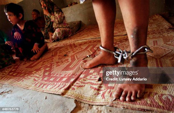 An Afghan woman stands with her ankles chained inside the women's ward of Kabul's only psychiatric hospital, in Kabul, Afghanistan on July 23, 2002....