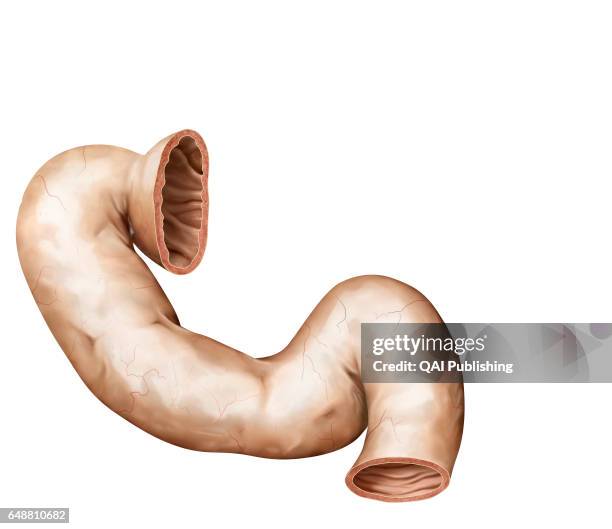 Duodenum Resection 1,452 Duodenum Stock Photos, High-Res Pictures, and Images - Getty Images