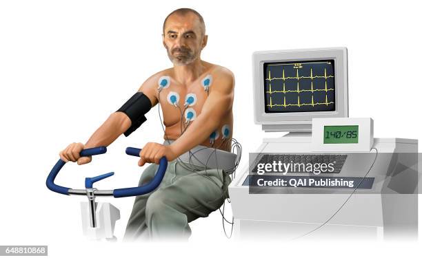 Stress test, Test that measures the heartÍs electrical activity during periods of physical exertion.