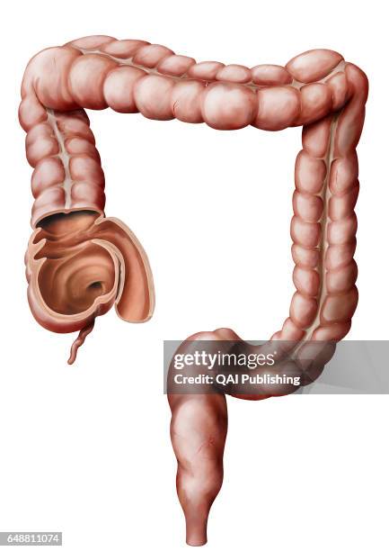 Large intestin, Last segment of the digestive tract, where final digestion and elimination of waste matter take place.