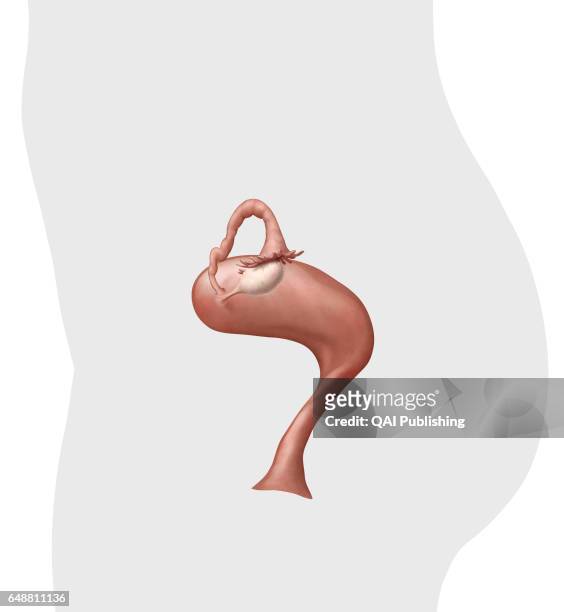 Uterus lateral view, The uterus is a hollow organ located between the bladder and the rectum in which the fetus develops during gestation. It is...