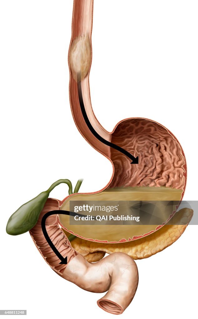 Digestive process
