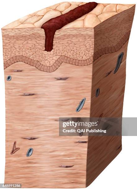 Capillary Stasis Capillaries Skin Photos and Premium High Res Pictures - Getty Images
