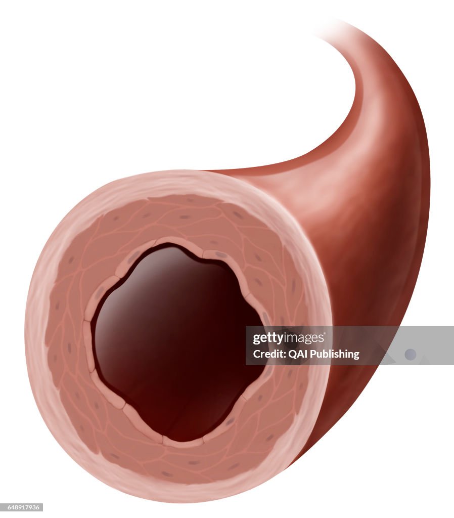 Vasoconstriction