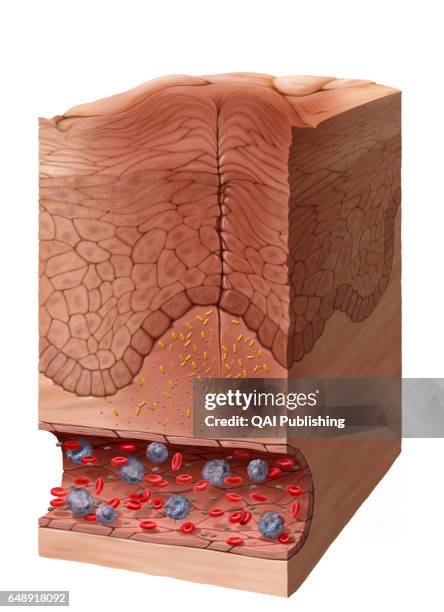 Dense Vs Diffuse Rash Skin Rash Photo Photos and Premium High Res Pictures - Getty Images