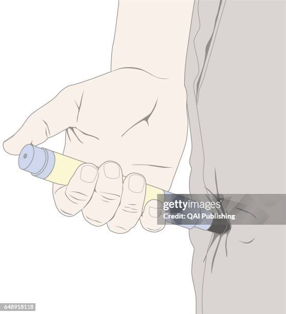 Adrenaline self-injector, If the person suffers from a serious allergy , ask them to use their EpiPen¬ adrenaline self-injector. Check the expiration...