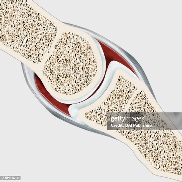 Interphalangeal joints, The interphalangeal joints are synovial joints that link the phalanxes of the fingers or the toes together. The great degree...