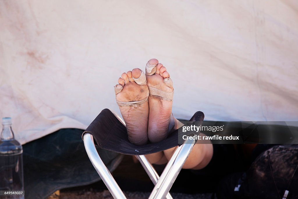 A man resting his blistered feet