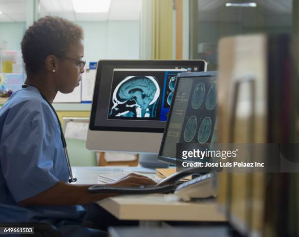 doctor examining x-rays in hospital - radiogram stockfoto's en -beelden