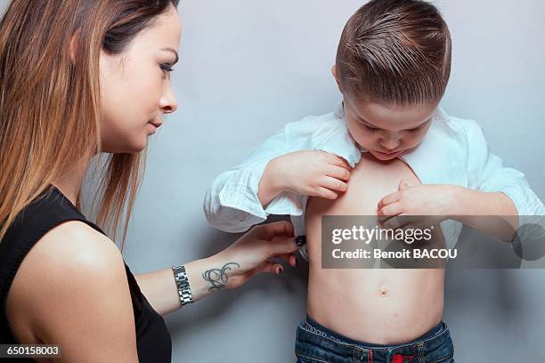 portrait of a boy and his mother watching chickenpox button - irritation cutanée photos et images de collection