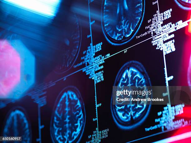 human brain scan in a neurology clinic - outil de diagnostic médical photos et images de collection